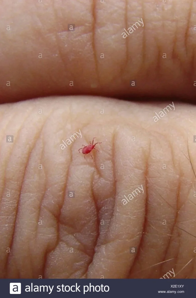 Can chiggers live on clothing