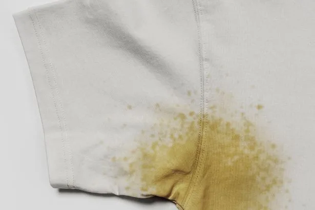 How to get the yellow stains out of white clothes